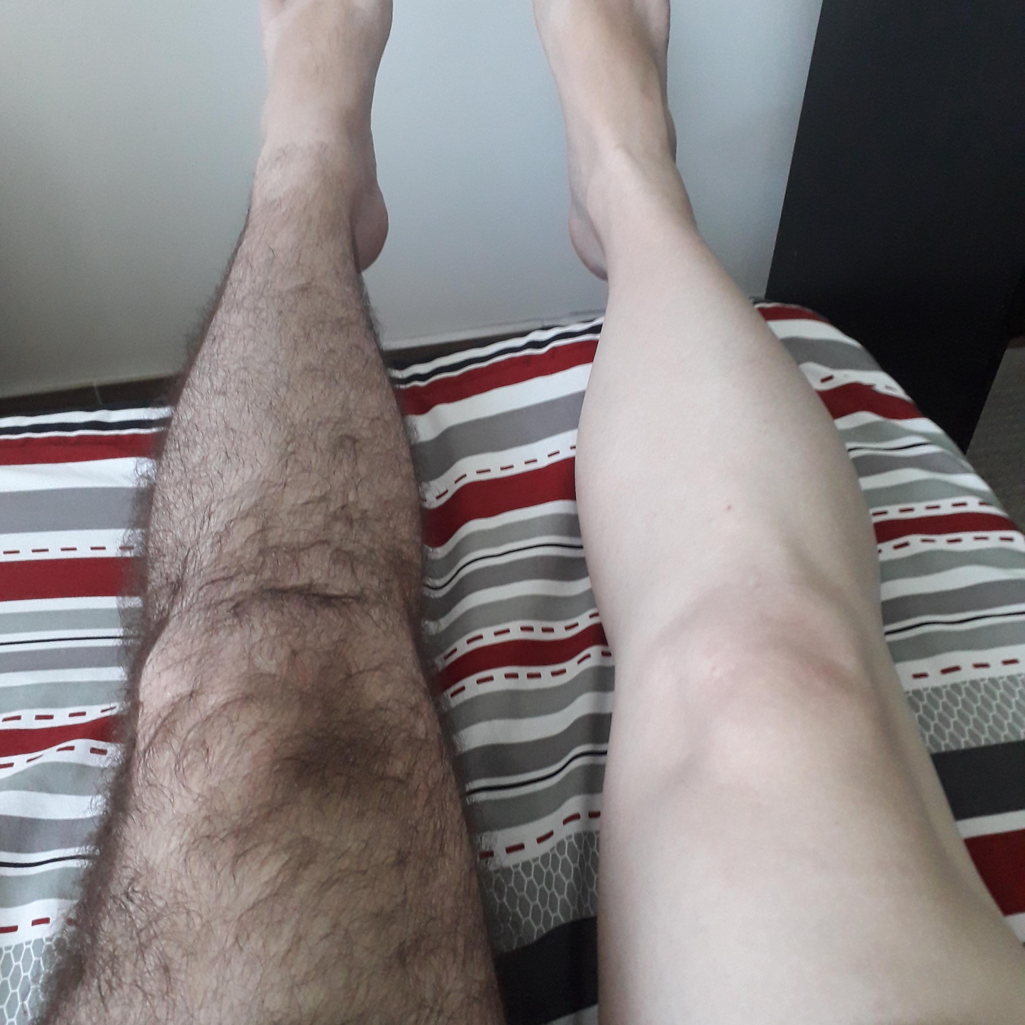 HairMaid® Hårfjerner