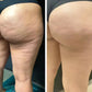 Muushy Smooth - Anti Cellulite Massager